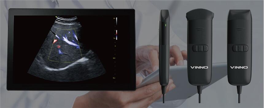 ft(y)ṩwZVINNO Qϵһʽ߶˲ɫճ\x