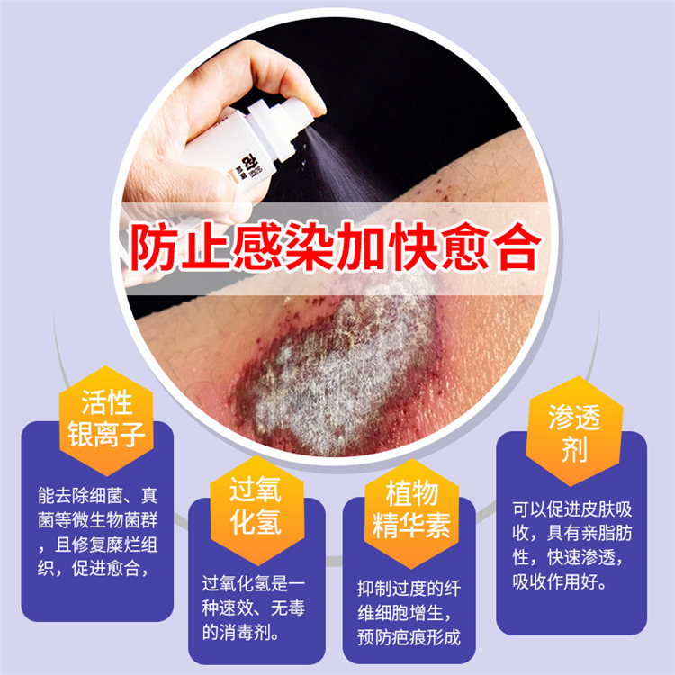 гˎƷ(chung)FֹWmڸ(chung)